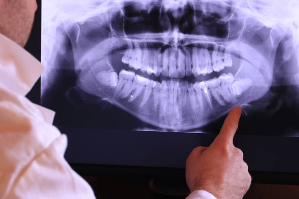Best Emergency Root Canal Treatment in Centreville, VA