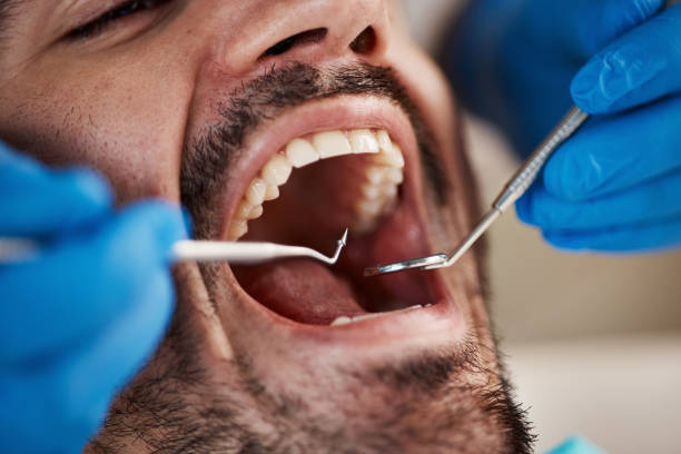 Best Weekend Emergency Dentist in Centreville, VA