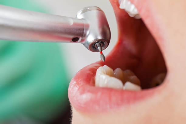 Best Holiday Emergency Dentist in Centreville, VA